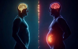 Mỡ nội tạng làm tăng nguy cơ suy giảm trí nhớ