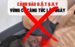 Chuyên gia y tế TP.HCM: Đau cổ vai gáy không có cơ chế trực tiếp gây ra đột quỵ