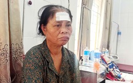 Lời kể của nạn nhân vụ xe khách va chạm xe đầu kéo khiến 1 người chết, 8 người bị thương