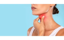4 dấu hiệu ung thư amidan dễ bị bỏ qua