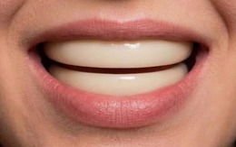 Câu hỏi đang viral: Tại sao con người cần đến 32 chiếc răng?