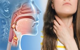 Triệu chứng ung thư vòm họng dễ nhầm với viêm họng, viêm xoang