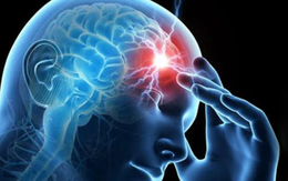 Chóng mặt, buồn nôn: Dấu hiệu đột quỵ tiểu não dễ nhầm với rối loạn tiền đình