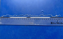 Tự nặn mụn trên cánh tay, phát hiện con giun rồng dài 20cm dưới da