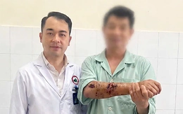 Đứt lìa tay chân, sơ cứu kiểu gì để nối lại được?