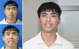 Phục hồi thành công gương mặt cho nam thanh niên liệt mặt suốt 7 năm