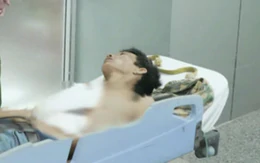 Người đàn ông giết vợ rồi trèo lên ngọn dừa trốn, bất ngờ ngã xuống đất chấn thương nặng