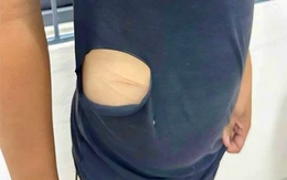 Tự làm bị thương, xé rách áo rồi báo tin giả bị cướp 40 triệu đồng, thanh niên bị xử phạt