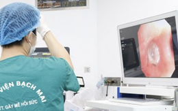 Viêm phổi tái phát, bác sĩ bất ngờ lấy ra... răng sâu trong phế quản