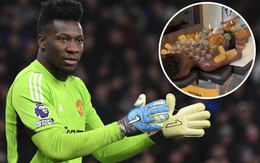 Andre Onana gây rợn người khi 'nâng tầm' liệu pháp giác hơi