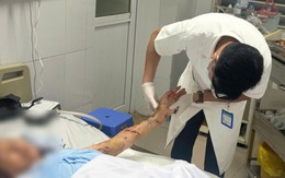 Nằm liệt giường, cụ bà 76 tuổi vẫn bị chó nhà tấn công phải nhập viện