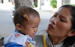 Nhánh cây khô rớt trúng đầu, 3 mẹ con bị thương