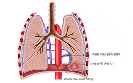 Thông tim cho trẻ ba tháng rưỡi tuổi