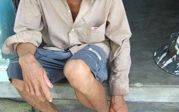 Khổ với bàn chân khổng lồ