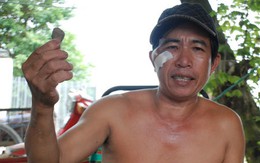 Kẻ trộm chó bắn người phát hiện