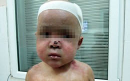 Thêm người Brazil muốn đến VN chữa trị