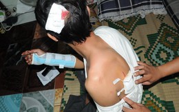 Hai người bị chém tại tiệc cưới