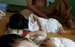 Triển lãm ảnh quốc tế về trẻ em da cam Việt Nam