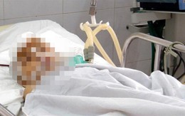 Rơi từ tầng 3 chung cư, một cháu bé nguy kịch