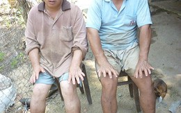 Hai anh em 48 ngón
