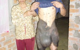 Chàng trai với "lớp da trâu"