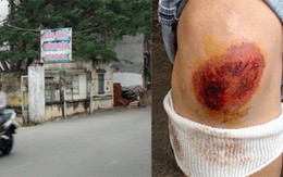 Khi trái bóng gây họa