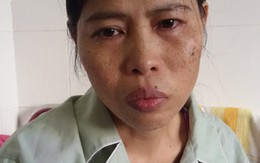 Chuyến ra viện buồn nhất