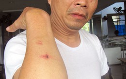Kéo côn đồ chặn xe khách, đánh người