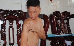 Làm rõ phản ánh  công an đánh trẻ vị thành niên