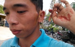 Một thanh niên bị công an đánh phải nhập viện