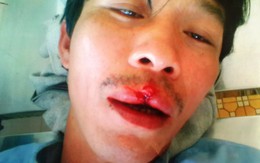 ​Kiểm lâm thương lượng bồi thường cho người dân bị bắn
