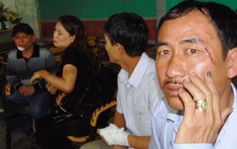 Giám đốc chợ Hội: "Tôi có đấm nhưng không trúng"