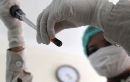 ​Australia thử nghiệm thuốc phòng chống lây nhiễm HIV