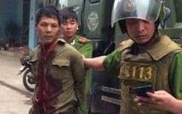 Xin tiền không được chém cụt tay chị gái