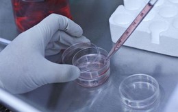 ​Tế bào gốc giúp ngăn chặn suy giảm thị lực