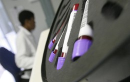 ​Thụy Sĩ: Giảm mạnh tình trạng HIV kháng thuốc
