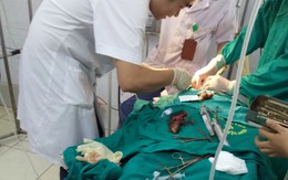 Ngậm cá rô, bị cá chui vào khí quản, nguy kịch
