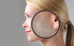 ​Những dấu hiệu nhận biết da bị lão hóa