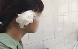Cô giáo khiêu vũ tố phụ huynh học viên lăng nhục, cắn đứt tai