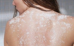 ​Hè đến rồi, hãy nói lời tạm biệt với mụn ở lưng và ngực