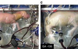 ​Tử cung nhân tạo tăng cơ hội sống cho trẻ sinh non