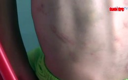 Clip điều tra vụ bé trai bị dì ruột dùng vật sắt đánh