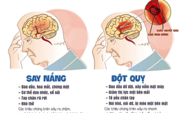 ​Nắng nóng kéo dài: Phòng ngừa nguy cơ đột quỵ