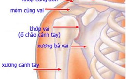 ​Xương đòn dễ gãy, dễ lành