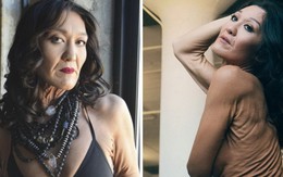 ​Cô gái 26 da nhăn như bà lão vẫn làm người mẫu