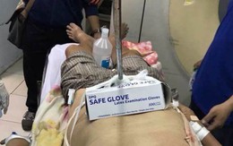 Cụ ông bị cán dù đâm thủng bụng, ​bàng quang