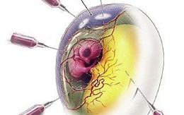 Hàng triệu quả trứng quý  đành vô dụng trước virus corona