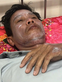 Ba người trôi dạt 2 ngày và sống sót thần kỳ: Cô độc là khoảnh khắc đáng sợ nhất