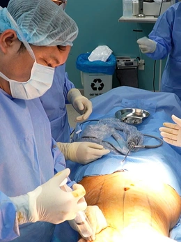 Thủng ruột, nhiễm trùng, trầm cảm là biến chứng thường gặp phẫu thuật thẩm mỹ hiện nay