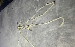 Nearly-10-meter pork tapeworm found parasitizing man in Vietnam